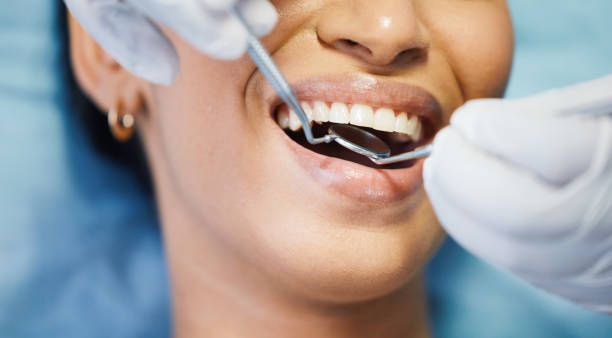 Best Dental Studio in Carson, WA